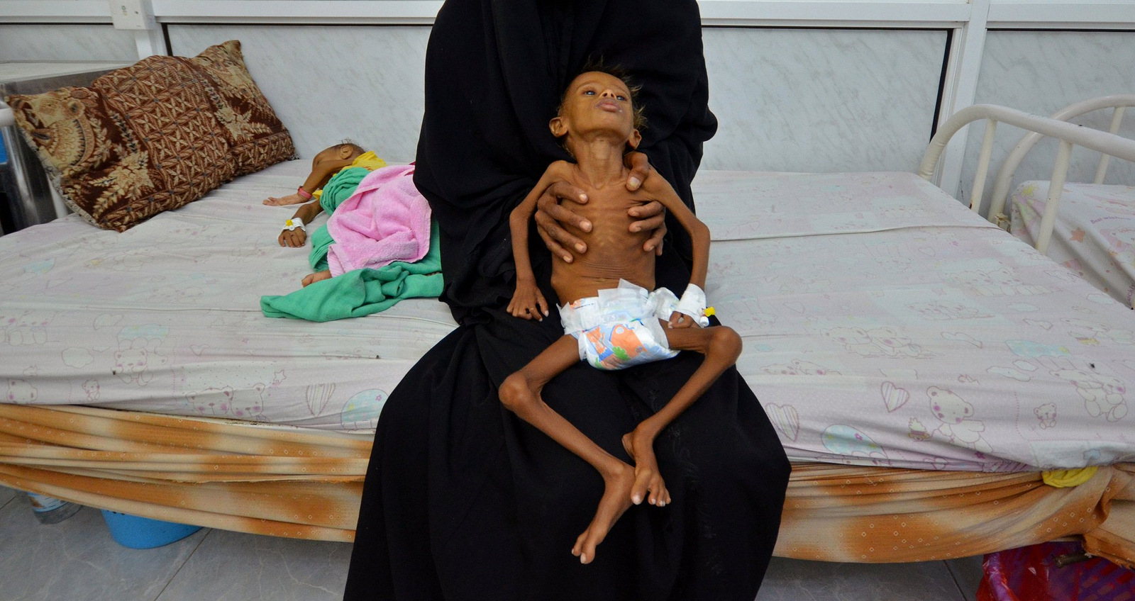 ENSZ: 18,4 millió embert fenyeget az éhhalál Jemenben az év végéig